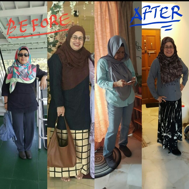 before-after